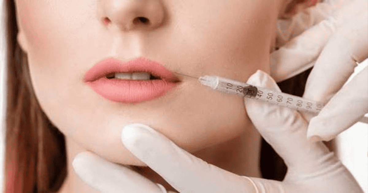 Lees meer over het artikel Hyaluronzuur injectie behandeling: wat kun je verwachten?